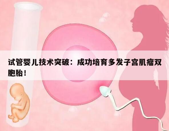 试管婴儿技术突破:成功培育多发子宫肌瘤双胞胎!