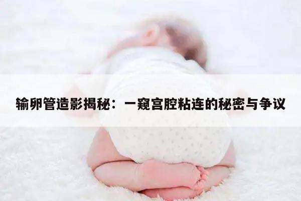 输卵管造影揭秘：一窥宫腔粘连的秘密与争议