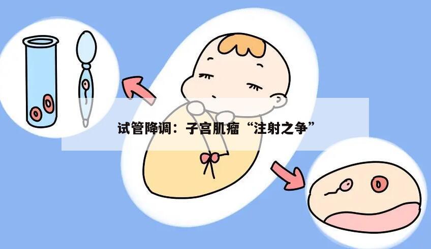 试管降调:子宫肌瘤“注射之争”