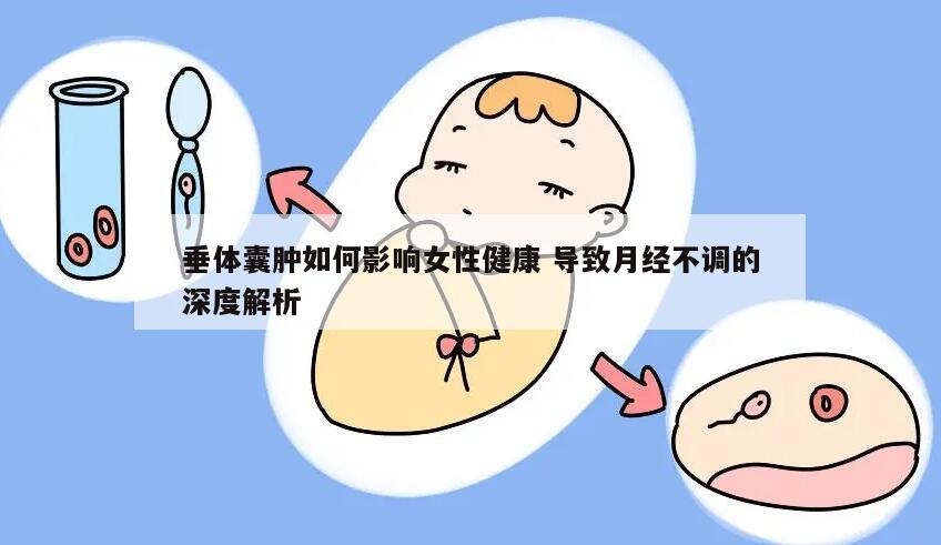 垂体囊肿如何影响女性健康 导致月经不调的深度解析