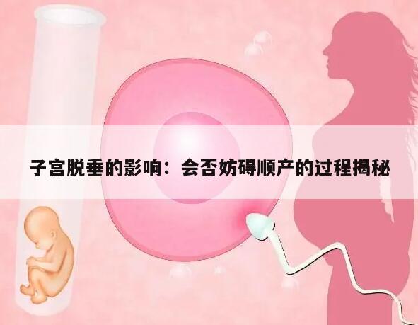 子宫脱垂的影响:会否妨碍顺产的过程揭秘
