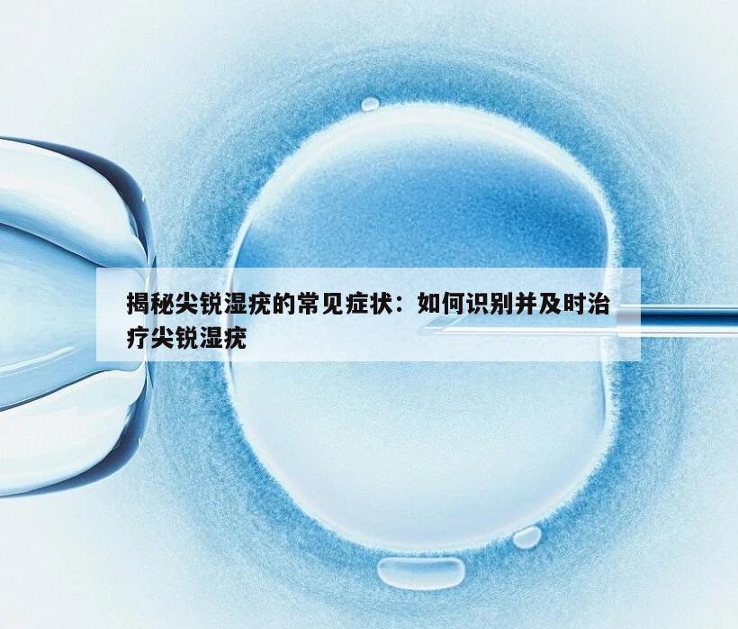 揭秘尖锐湿疣的常见症状：如何识别并及时治疗尖锐湿疣