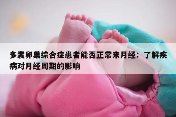 多囊卵巢综合症患者能否正常来月经:了解疾病对月经周期的影响