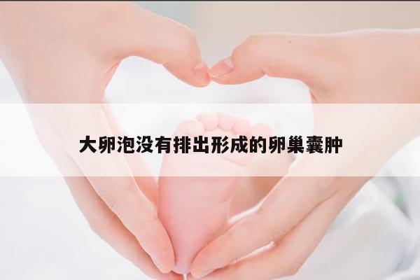 大卵泡没有排出形成的卵巢囊肿