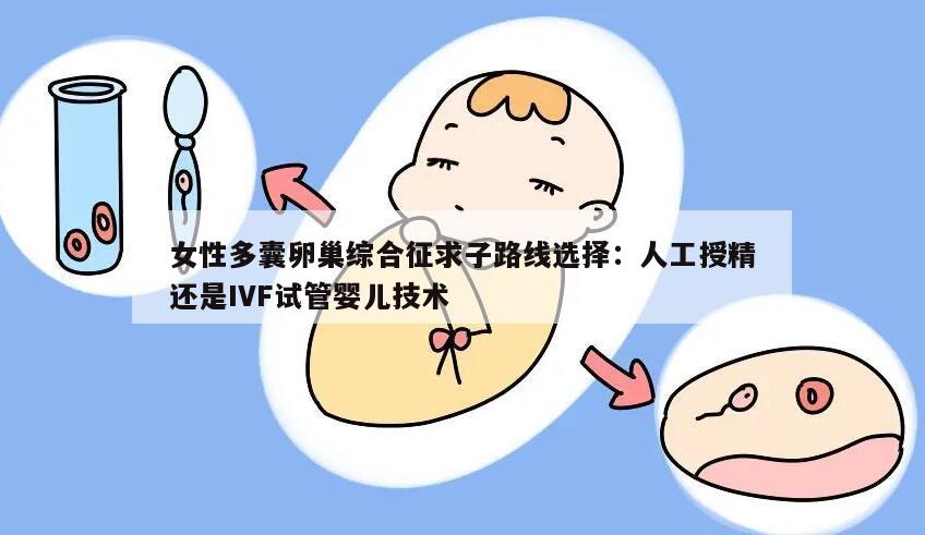 女性多囊卵巢综合征求子路线选择:人工授精还是IVF试管婴儿技术