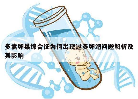 多囊卵巢综合征为何出现过多卵泡问题解析及其影响