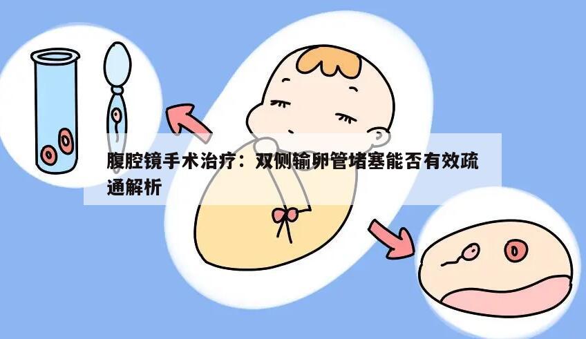 腹腔镜手术治疗：双侧输卵管堵塞能否有效疏通解析