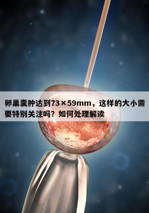 卵巢囊肿达到73×59mm,这样的大小需要特别关注吗?如何处理解读