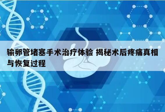 输卵管堵塞手术治疗体验 揭秘术后疼痛真相与恢复过程