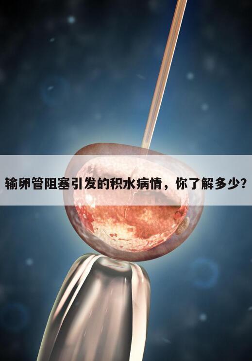 输卵管阻塞引发的积水病情,你了解多少?