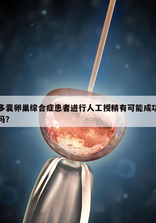 多囊卵巢综合症患者进行人工授精有可能成功吗?