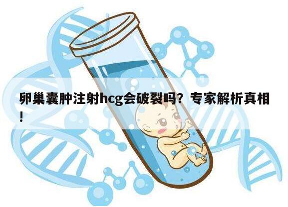 卵巢囊肿注射hcg会破裂吗？专家解析真相!