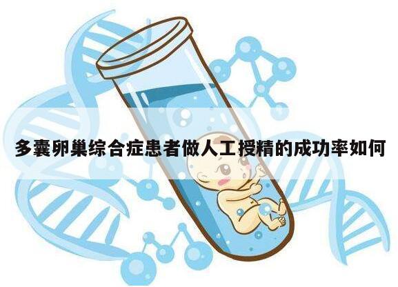 多囊卵巢综合症患者做人工授精的成功率如何