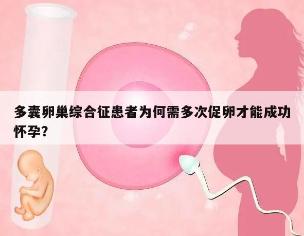 多囊卵巢综合征患者为何需多次促卵才能成功怀孕？