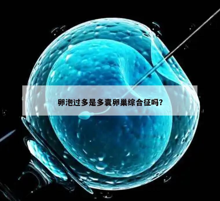 卵泡过多是多囊卵巢综合征吗?