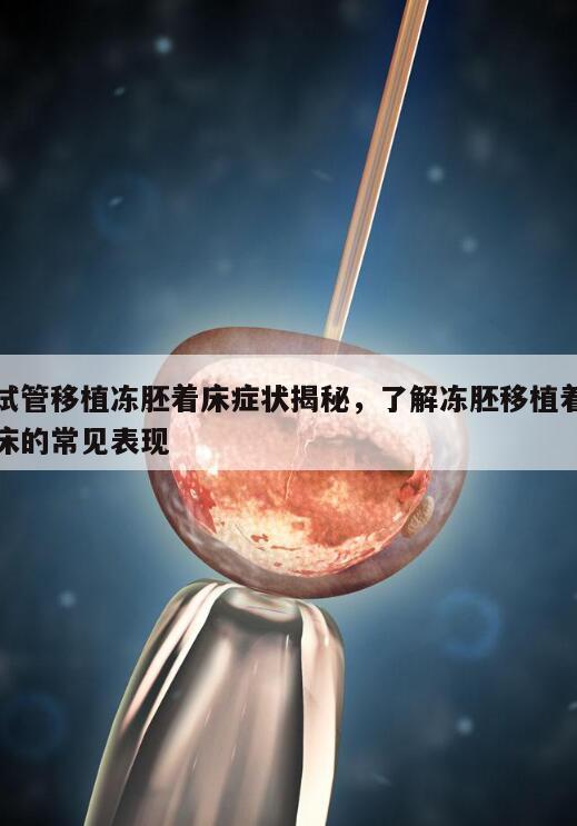 试管移植冻胚着床症状揭秘,了解冻胚移植着床的常见表现