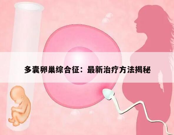 多囊卵巢综合征：最新治疗方法揭秘