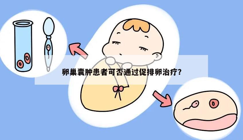 卵巢囊肿患者可否通过促排卵治疗？