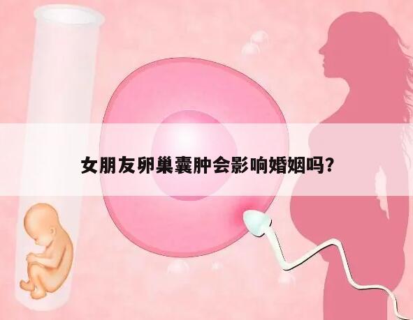 女朋友卵巢囊肿会影响婚姻吗?