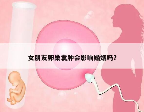 女朋友卵巢囊肿会影响婚姻吗？