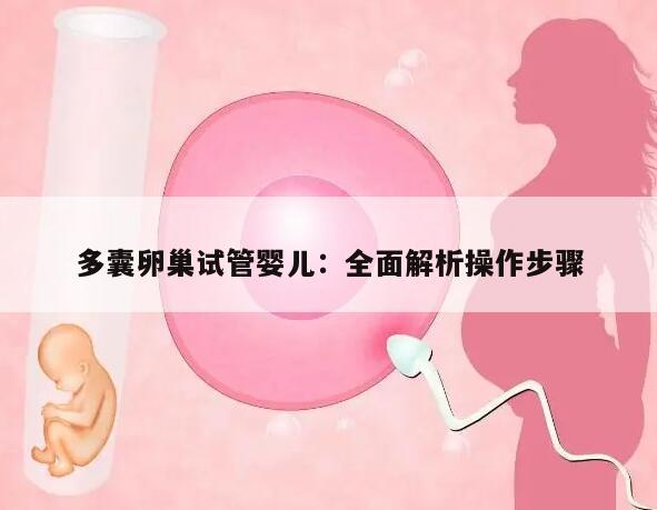 多囊卵巢试管婴儿：全面解析操作步骤