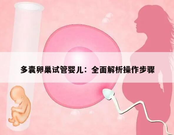 多囊卵巢试管婴儿:全面解析操作步骤
