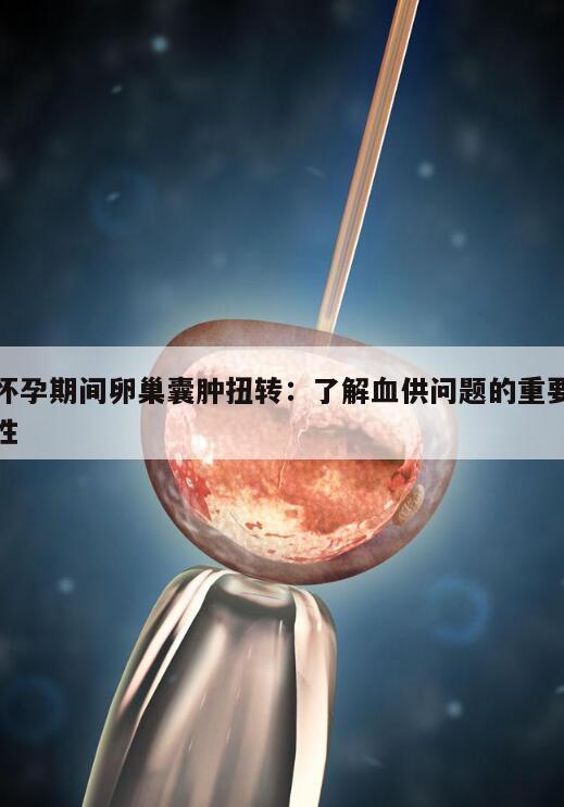 怀孕期间卵巢囊肿扭转:了解血供问题的重要性
