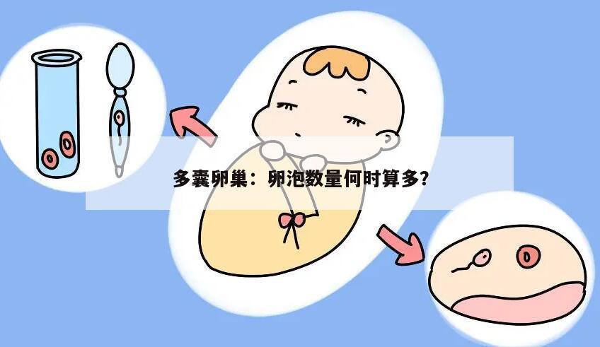 多囊卵巢:卵泡数量何时算多?