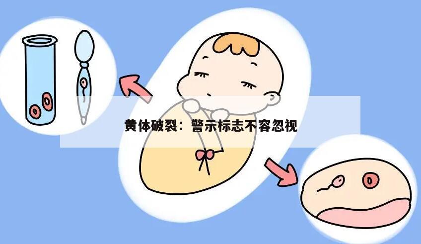黄体破裂:警示标志不容忽视