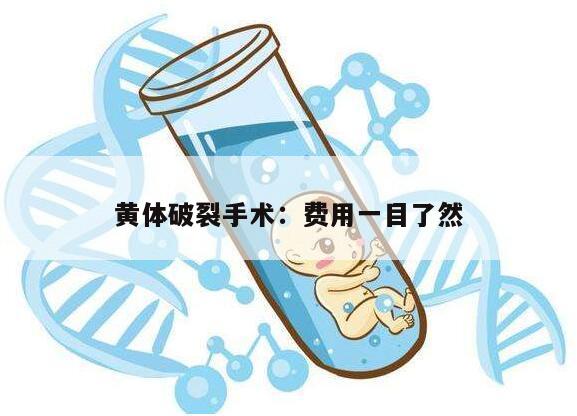 黄体破裂手术：费用一目了然
