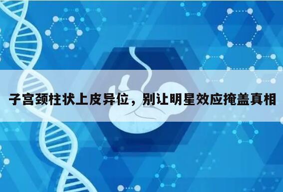 子宫颈柱状上皮异位,别让明星效应掩盖真相