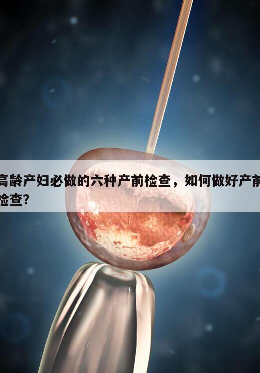 高龄产妇必做的六种产前检查，如何做好产前检查？