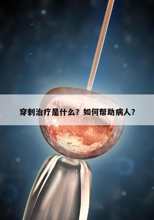 穿刺治疗是什么?如何帮助病人?
