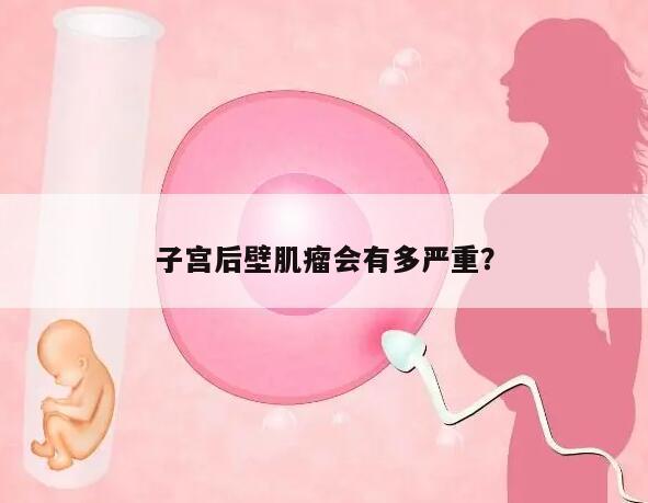 子宫后壁肌瘤会有多严重?