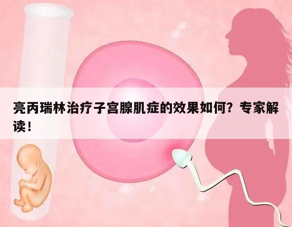 亮丙瑞林治疗子宫腺肌症的效果如何?专家解读!