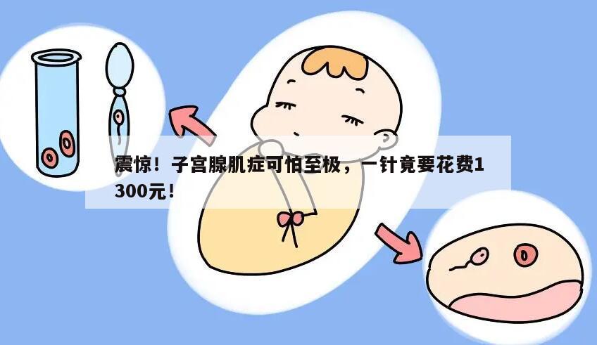 震惊!子宫腺肌症可怕至极,一针竟要花费1300元!