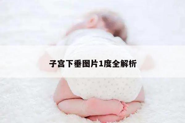 子宫下垂图片1度全解析
