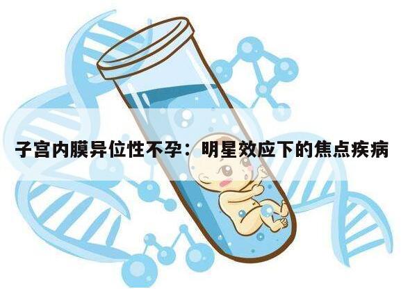 子宫内膜异位性不孕：明星效应下的焦点疾病