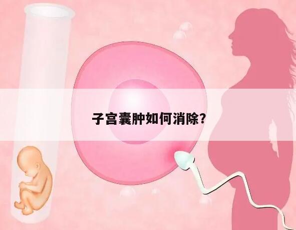 子宫囊肿如何消除?