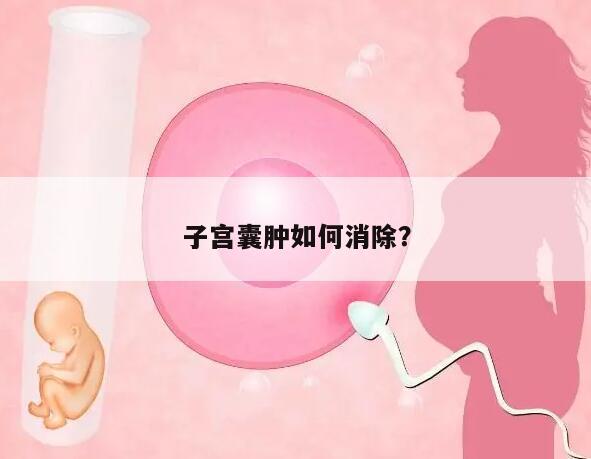 子宫囊肿如何消除？