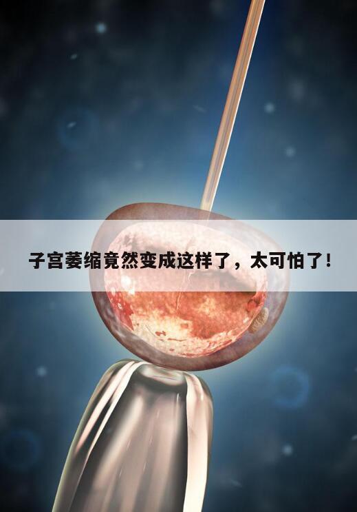 子宫萎缩竟然变成这样了,太可怕了!