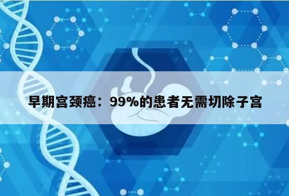 早期宫颈癌：99%的患者无需切除子宫