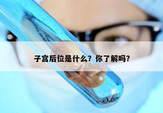 子宫后位是什么?你了解吗?
