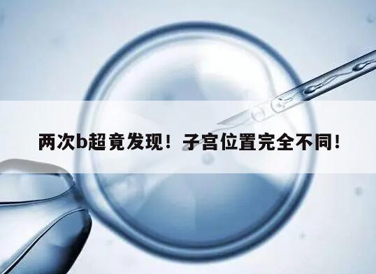 两次b超竟发现!子宫位置完全不同!