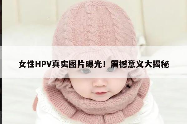 女性HPV真实图片曝光！震撼意义大揭秘